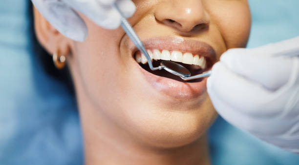 Best Emergency Care for Gum Disease in Rockwood, MI